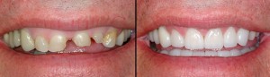 Dental Surgeon result